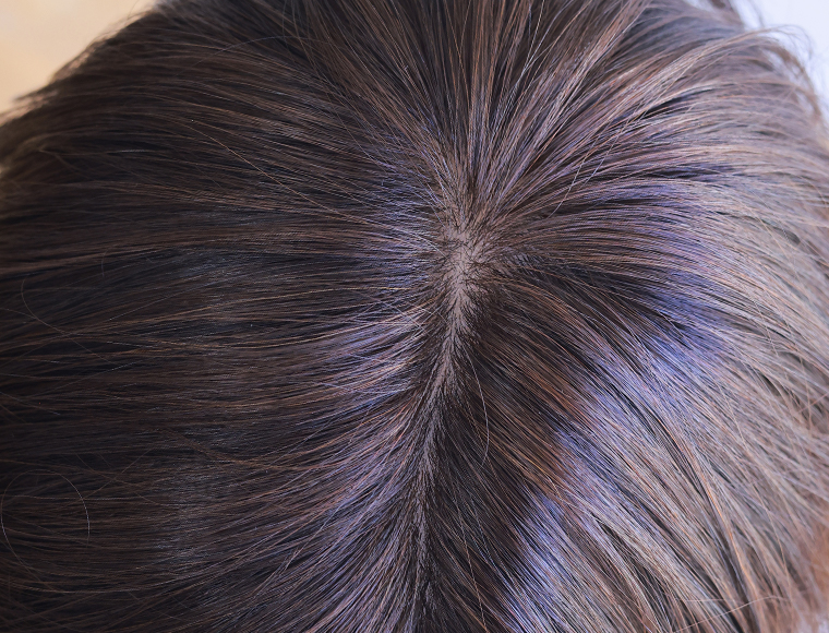 �l�H���i�l�H�畆�j�̔閧